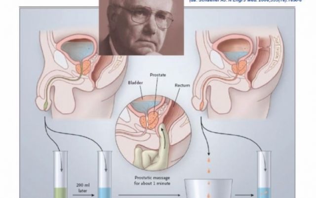 prostatitis test)